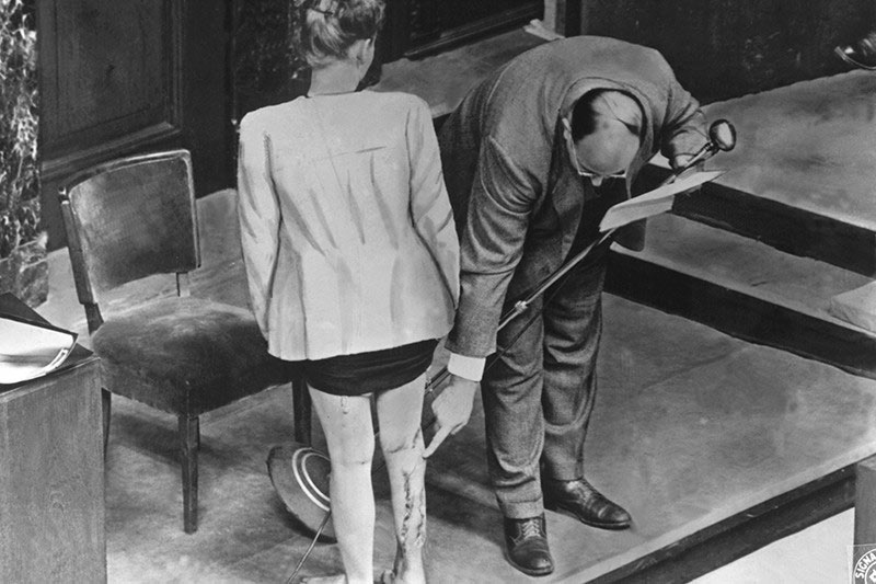 Осмотр шрамов на ноге польской свидетельницы на Нюрнбергском процессе как доказательство последствий экспериментов немецких врачей Фрица Фишера и Герты Оберхойзер.