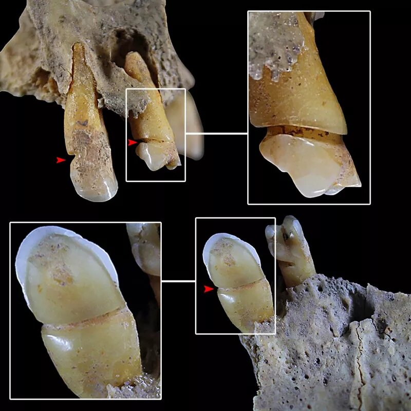 Древние зубы указали на гендерное разделение труда