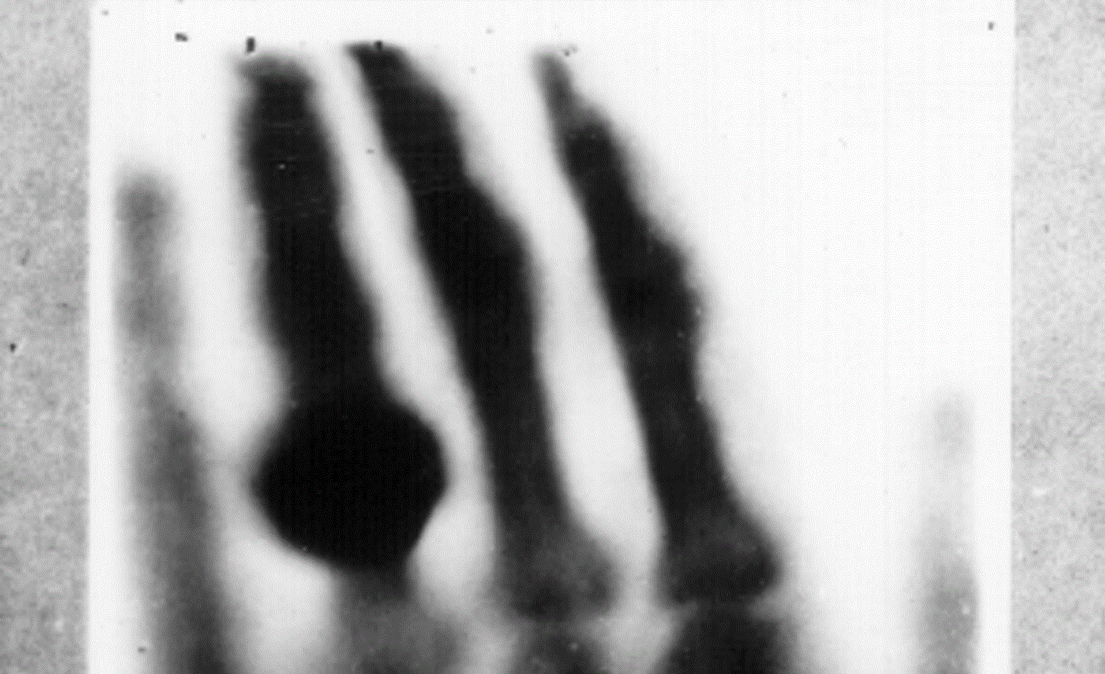 Один из первых снимков, сделанных Рентгеном. В качестве «модели» выступила его жена. 1895 г.