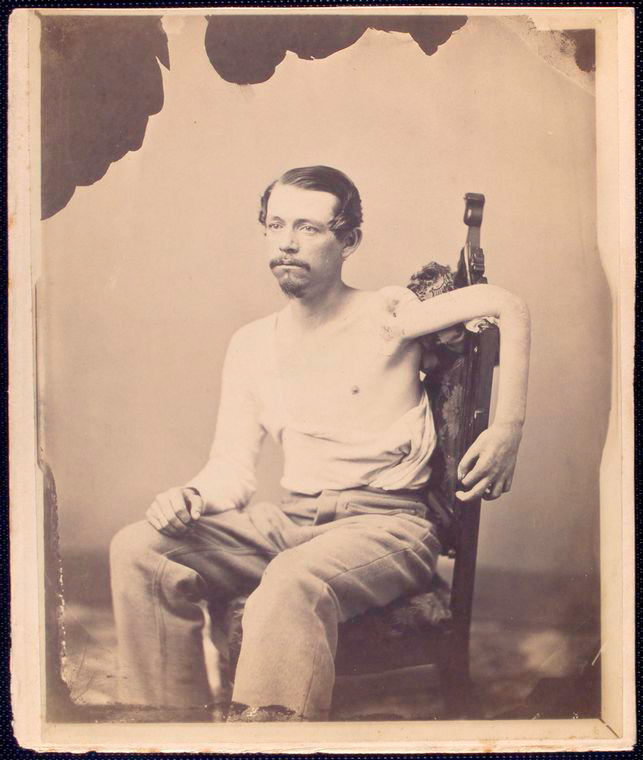 Раненый.jpg john-f-claghorn--214-gold-st-brooklyn-li_3110015223_o.jpg