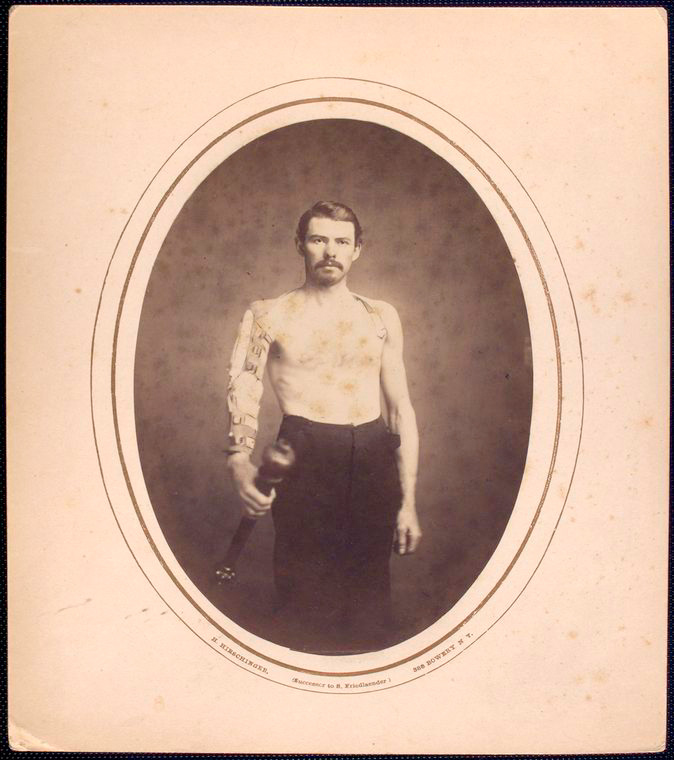 Раненый.jpg shirtless-man-stands-with-right-arm-in-brace-and-harness-g_3110847168_o.jpg