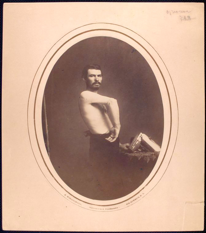 Раненый.jpg shirtless-man-stands-sideways-displaying-right-forearm-bra_3110847052_o.jpg