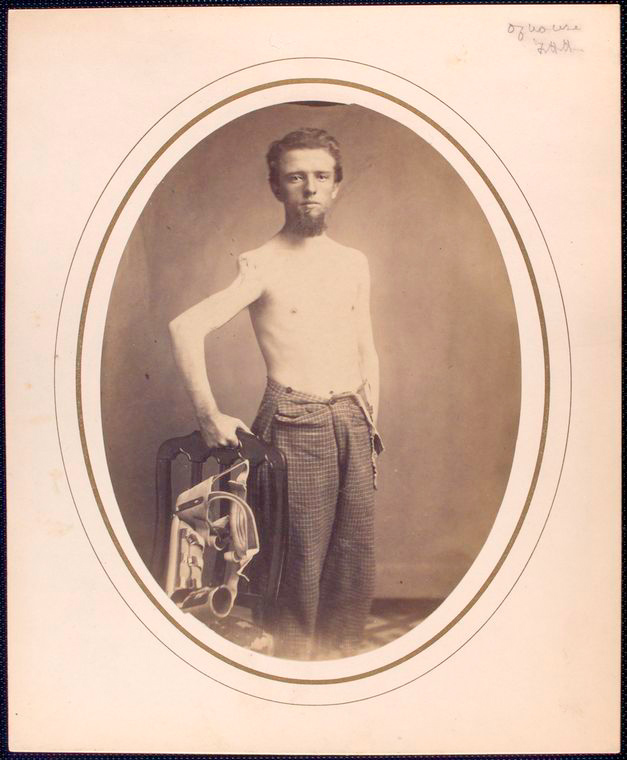 Раненый.jpg shirtless-man-standing-displays-wounded-right-shoulder-g_3110846472_o.jpg